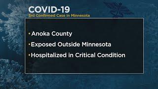 Coronavirus In Minnesota: MDH Confirms 3rd Presumptive Case Of COVID-19, Patient In Critical Conditi