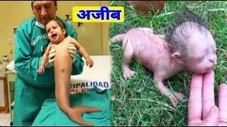 5 सबसे अजीब बच्चे जिनको देखने में नसीब लगता है top 5  Amazing kids in the world