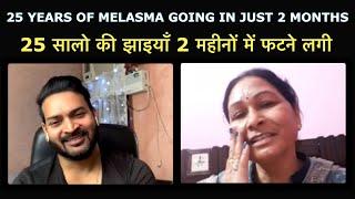 25 Years of Melasma gone in just 2 months. 25 सालो की झाइयाँ 2 महीनों में फटने लगी।