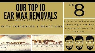 TOP 10 EAR WAX REMOVAL VIDEOS - NUMBER 8