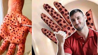 It is a sick place where insects grow in the hand ||top 10 amazing fact || assmese fact||