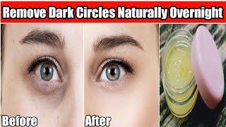 Dark Circles,Wrinkles Removal & Anti aging Best Eye Cream|Remove Dark Circles Overnight Naturally|