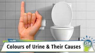 Colours of Urine and their Causes