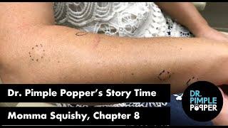 Dr. Pimple Popper's Weekly Story Time: Momma Squishy, Chapter 8!