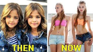 Top 10 Most Beautiful Kids In The World ALL GROWN UP