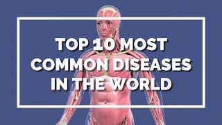 Top 10 most common diseases in the world