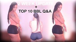 2 WEEK UPDATE + TOP 10 2020 BBL Q&A: How much | Regrets| Fluff fairy | Pain| Complications & more