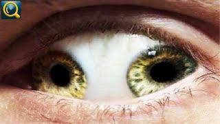 10 Weirdest And The Most Terrifying Eyes