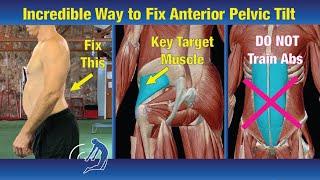 Incredible Way to Fix Anterior Pelvic Tilt - A Must See!