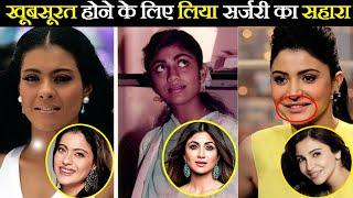 Top 10 Bollywood Actress Shoking Face With Makeup Without Makeup