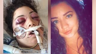 Eye Surgery Saves Woman’s Vision After Drunk Driving Crash