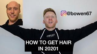 HOW TO GET A HAIR SYSTEM 2021. Giving you my Top 10 tips.