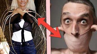 Top 10 People With Unusual Body Parts | Wonderful body parts