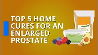 Top 5 Home Cures For Enlarged Prostate (BPH)