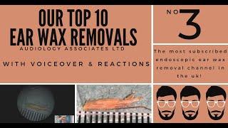 TOP 10 EAR WAX REMOVAL VIDEOS - NUMBER 3