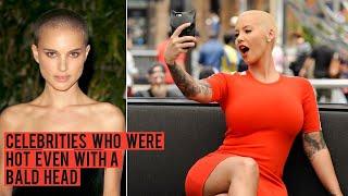 Top 10 Celebrities Hot Even With a Bald Head