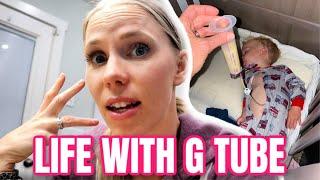 Day in the life of family vloggers of child with G tube | Surgery and Healing | Meet the Millers