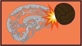 Football’s Dementia Problem