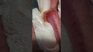 A bug inside in men's lips operation,, 