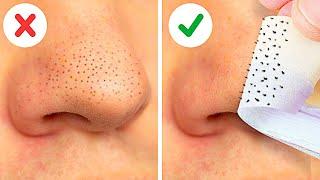 22 EASY WAYS TO REMOVE BLACKHEADS FAST || FACE MASKS, NATURAL BEAUTY HACKS