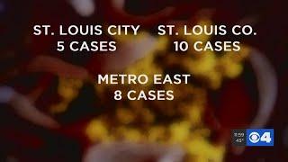 Missouri coronavirus cases reach 47