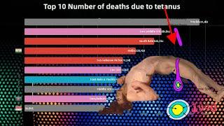 Top 10 Number of deaths due to tetanus