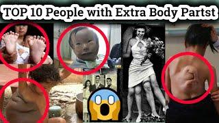 TOP 10 People with Extra Body Parts