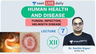 Human Health & Disease - L 7 | Fungal Infection | Unacademy NEET | LIVE DAILY | Biology | Sachin Sir