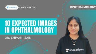 Top 10 expected images in Ophthalmology | Dr. Shivani Jain