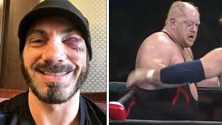 Top 10 Most Graphic Wrestling Injuries