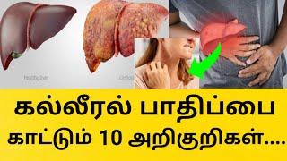 கல்லீரல் பாதிப்பின் அறிகுறிகள் |10 Early Signs of Liver Damage |  symptoms of liver problems inTamil