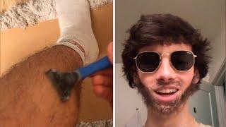 Teen Uses Leg Hair To Form A Beard