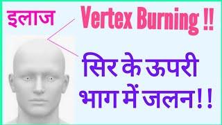 #Burning Of Vertex#Burning of Top of Head#खोपड़ी के ऊपरी भाग में जलन का कारण और इलाज#सिर में जलन