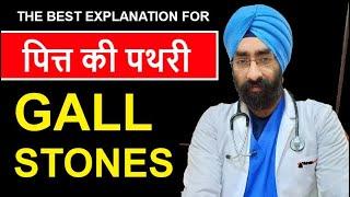 Best Explanation of Gall Stones - Ever | Dr.Education