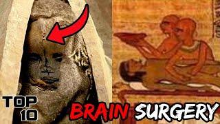 Top 10 Scary Surgeries Egyptians Actually Performed