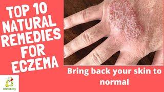 Top 10 natural REMEDIES to cure ECZEMA skin problem quickly | Eczema Treatment | Eczema on face