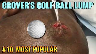 Grover's Golf Ball Bump - Top Ten All Time #10