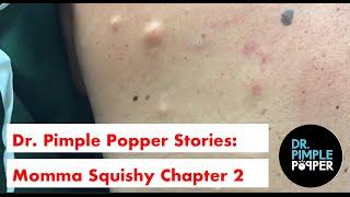 Dr. Pimple Popper's Weekly Story Time: Momma Squishy, Chapter 2