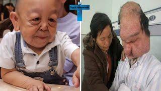 Top 10 Real Unbelievable People With Genetic Mutations