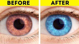 10 Things That Can Change Your Eye Color