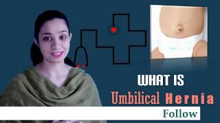 What is Umbilical Hernia|| Symptoms, Causes and Treatments || For all Parents (Hindi/Urdu)