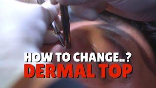 Cara Mengganti Perhiasan Dermal Piercing | How To Change MicroDermal Top by Piercing Indonesia