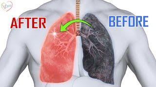 LUNG DETOX SECRETS: 10 NATURAL REMEDIES TO CLEAN YOUR LUNGS - SMOKERS AND NON-SMOKERS