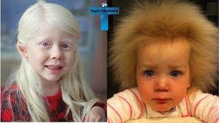 Top 10 Most Amazing And Unusual Kids In The World #5