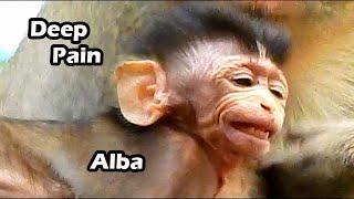 Pain Life Poor Baby ALBa Do Very Suffer Face | Alba Born With Hard And Miserable Life By ANNa