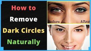 How to Remove Dark Circles Naturally 