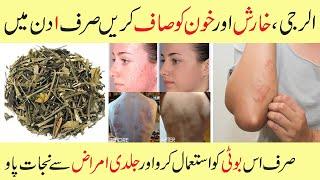 Top 10 Chirata Benefits in Urdu - How to Use Herbal Chirata at Home - Skin Alerji Ka ilaj at Home