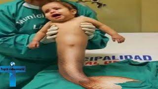Top 10 Amazing And Unusual Kids Born With Rare Medical Conditions
