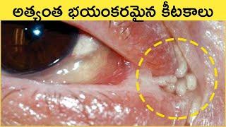 Most Dangerous Bug in The World | Top Interesting Facts in Telugu | Great Sparkle | SFE-74