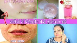 Use Glycerin this Winter & Get Soft Glowing Spotless Skin- 5 Top Uses Of Glycerin for Face